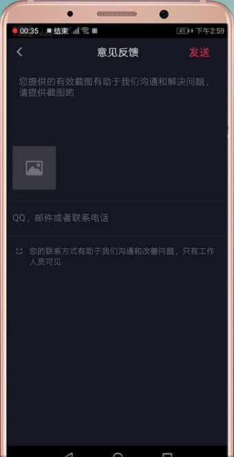 在抖音里联系客服的基础操作截图